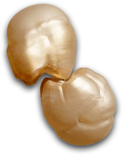 MUELA ZIRCONIO KEROX